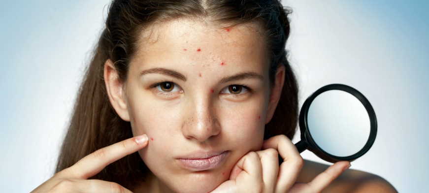 avoid patchy face