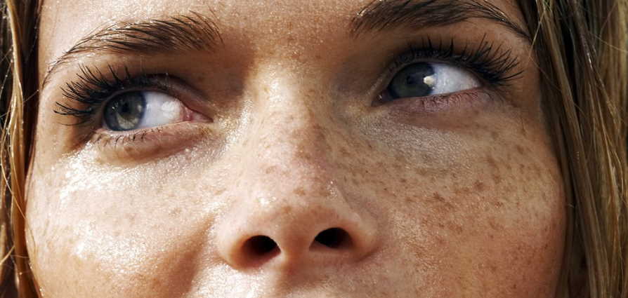 skin type