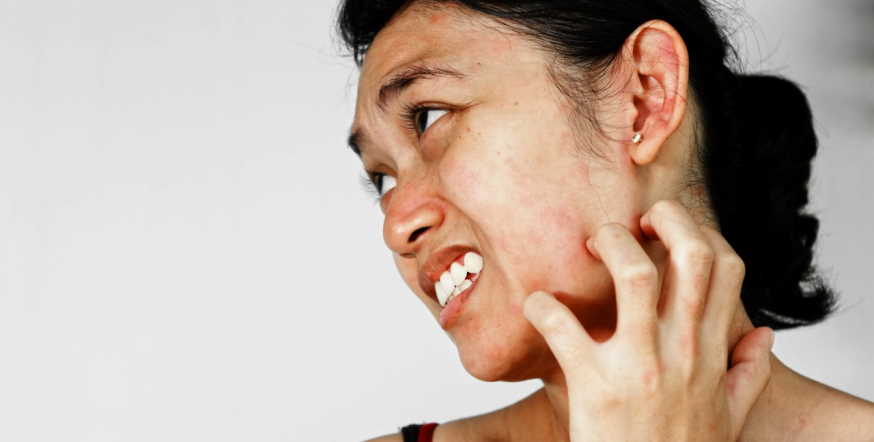 dry skin